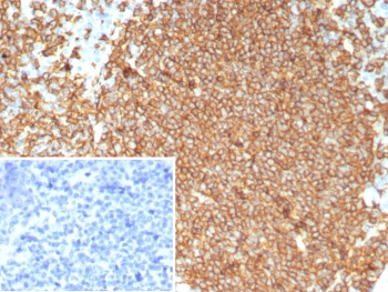 CD20 Antibody