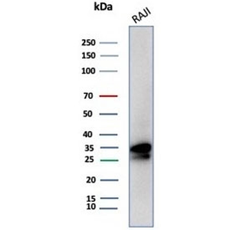 CD20 Antibody
