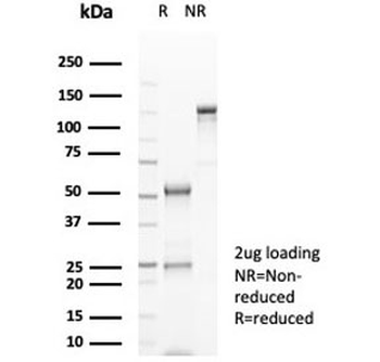 CD20 Antibody