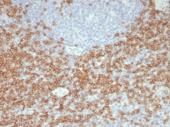 CD5 Antibody