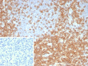 CD5 Antibody