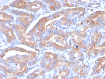 SI-CLP Antibody / CHID1