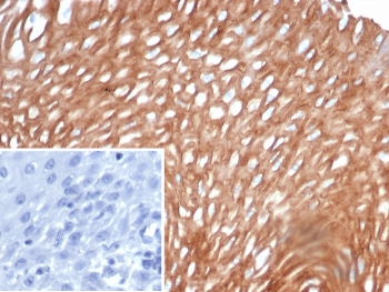 SI-CLP Antibody / CHID1