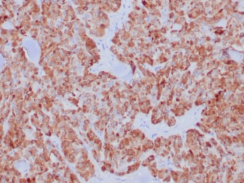 Calcitonin Antibody / CALCA / CGRP