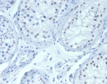Wilms Tumor 1 Antibody