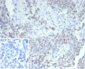 Wilms Tumor 1 Antibody
