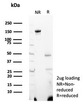 WT1 Antibody / Wilms Tumor 1