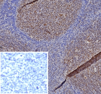 MGMT Antibody