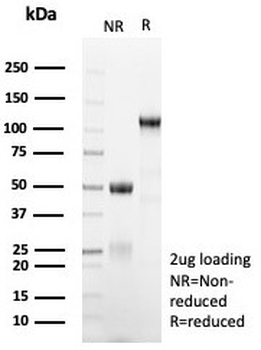 MGMT Antibody