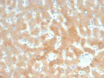 Retinol Binding Protein 4 Antibody / RBP4