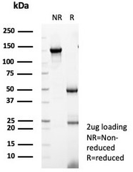 Retinol Binding Protein 4 Antibody / RBP4