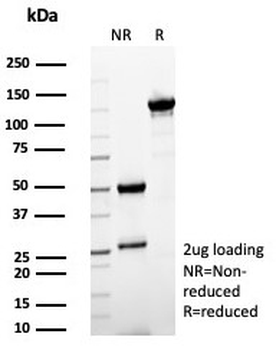 Surfactant protein D Antibody / SFTPD