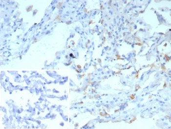 Surfactant protein D Antibody / SFTPD