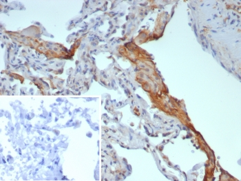 Surfactant protein D Antibody / SFTPD
