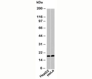 Acid Phosphatase / ACP1 Antibody