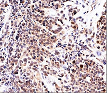 p21 Antibody