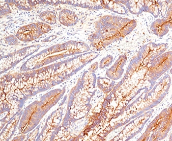 CEA Antibody / Carcinoembryonic Antigen