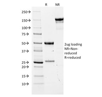 CEA Antibody / Carcinoembryonic Antigen