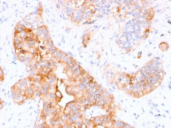 CEA Antibody / Carcinoembryonic Antigen
