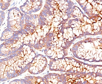 CEA Antibody / Carcinoembryonic Antigen
