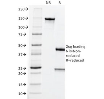 CEA Antibody / Carcinoembryonic Antigen
