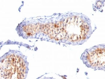 MART-1 Antibody Cocktail