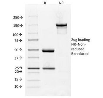 VEGFR1 Antibody / FLT1