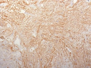 FN1 Antibody / Fibronectin