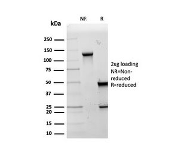 HSP60 Antibody / HSPD1
