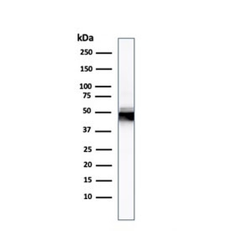 Cytokeratin 8 Antibody