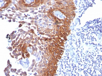Cytokeratin 17 Antibody