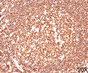 CD45 Antibody Cocktail