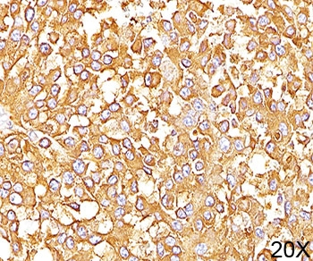 PMEL17 / Melanoma gp100 Antibody