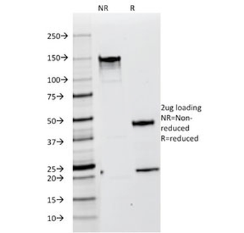 PMEL17 / Melanoma gp100 Antibody