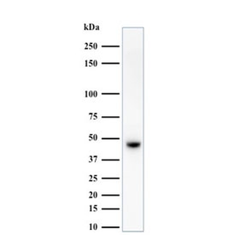 HMW Cytokeratin Antibody / Basic / Type II