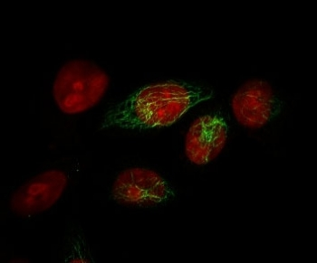 HMW Cytokeratin Antibody / Basic / Type II