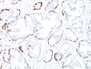 HMW Cytokeratin Antibody / Basic / Type II
