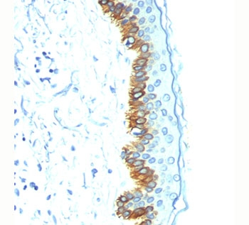 Acidic Cytokeratin Antibody