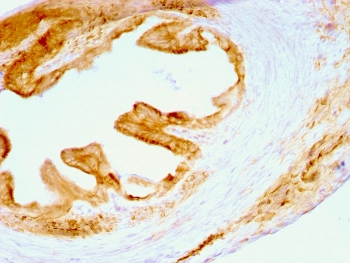 Multi Cytokeratin Antibody 4/5/6/8/10/13/18