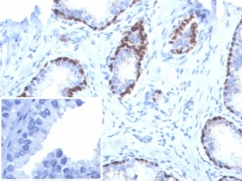 Recombinant p40 Antibody / deltaNp63