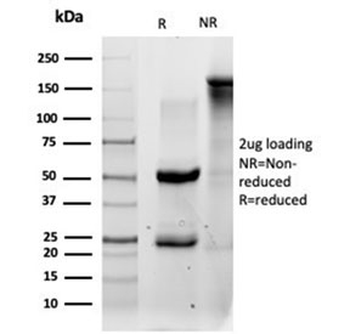QKI Antibody / Protein Quaking