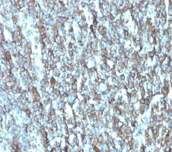 Migfilin-1 Antibody / FLNB / Filamin B / FBLIM1