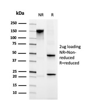 Migfilin-1 Antibody / FLNB / Filamin B / FBLIM1