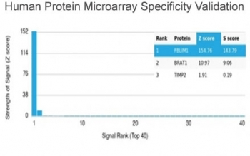 Migfilin-1 Antibody / FLNB / Filamin B / FBLIM1