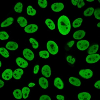 Recombinant Human Nuclear Antigen Antibody