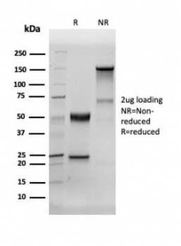 Recombinant Human Nuclear Antigen Antibody