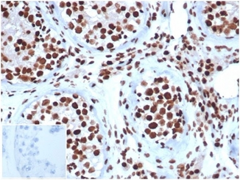 INI1 Antibody / Integrase interactor 1 / SMARCB1 / BAF47