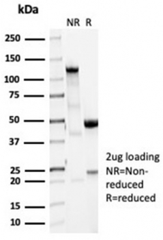 Recombinant Vinculin Antibody