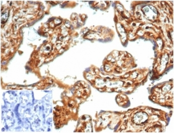 Recombinant Vinculin Antibody