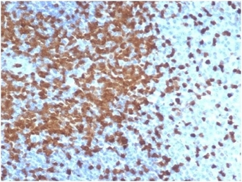 Recombinant ZAP70 Antibody